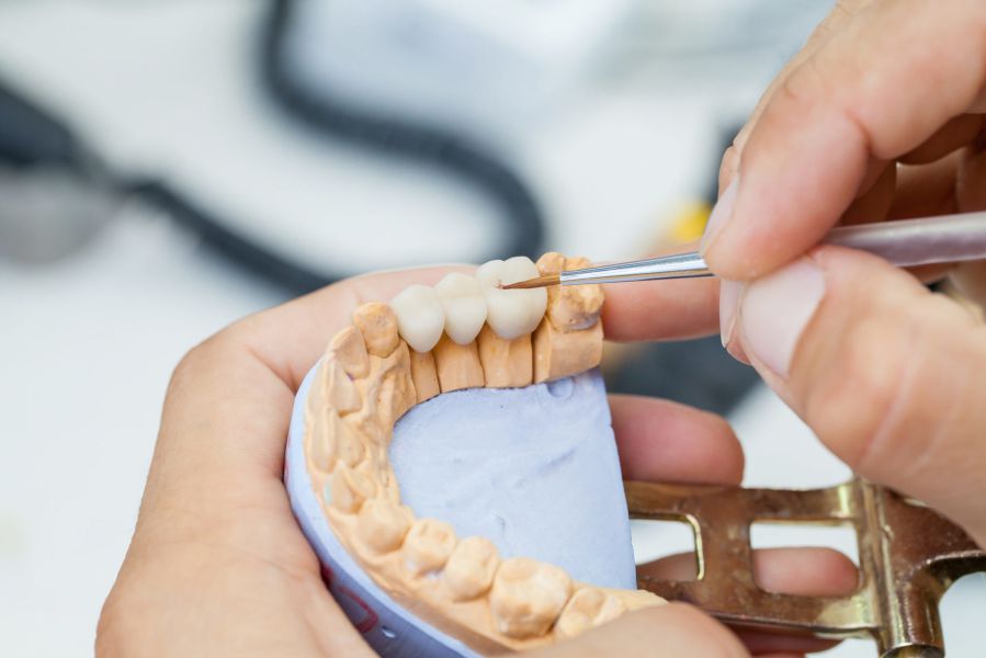 Học kỹ thuật phục hình răng
